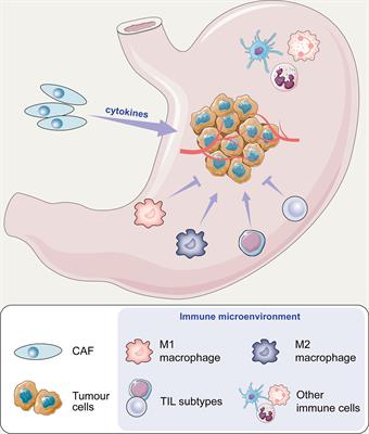 The Immune Microenvironment in Gastric Cancer: Prognostic Prediction